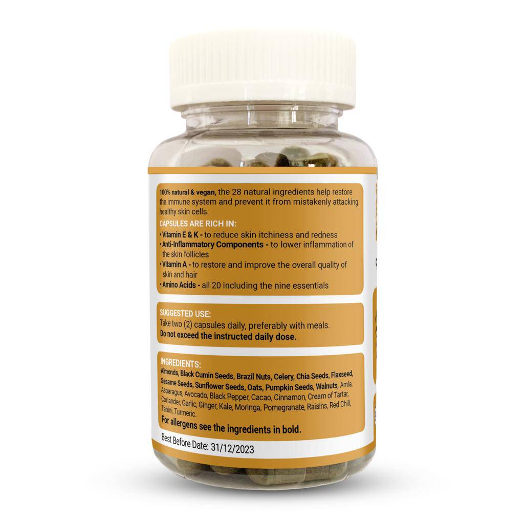 Bottle of Strength & Spices Psoriasis Relief 1000mg supplement capsules, showing the label and 60 capsules inside.